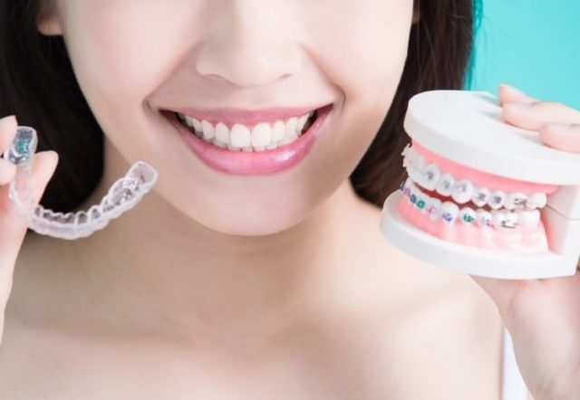 Invisalign Tooth Straightening System Guide
